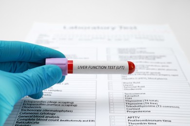 Laboratory worker holding tube with blood sample and label Liver Function Test near form at table, closeup