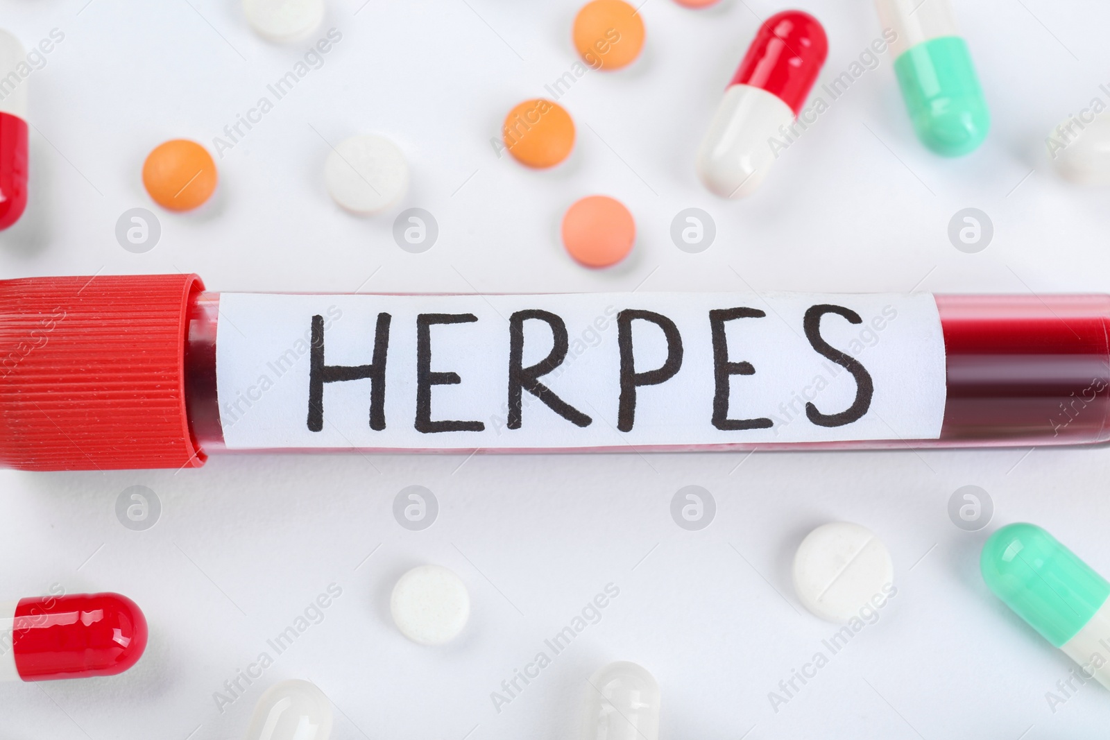 Photo of Test tube with word Herpes and different pills on white background, closeup