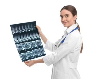 Orthopedist holding X-ray picture on white background