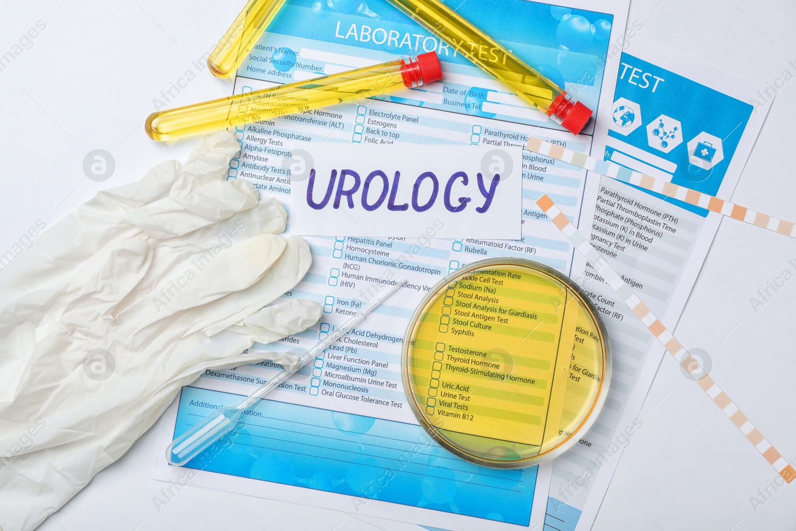 Photo of Flat lay composition with test forms and urine samples on light background. Urology concept