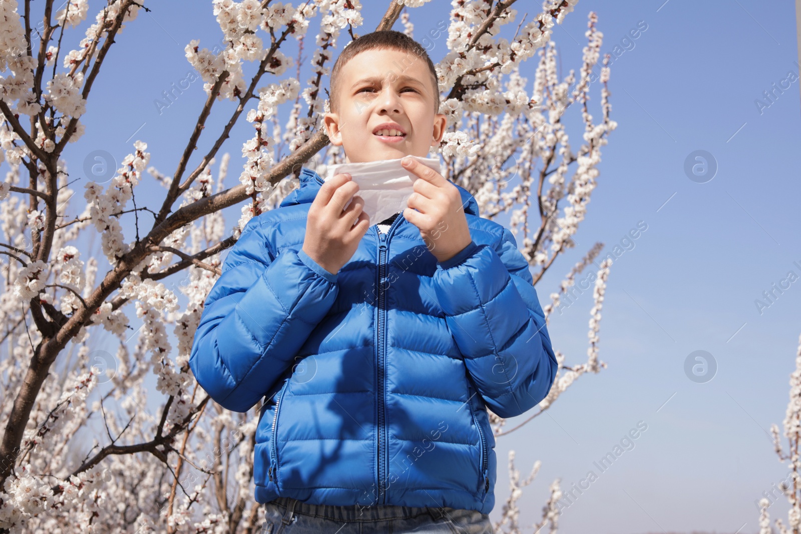 Photo of Little boy suffering from seasonal allergy outdoors on sunny day