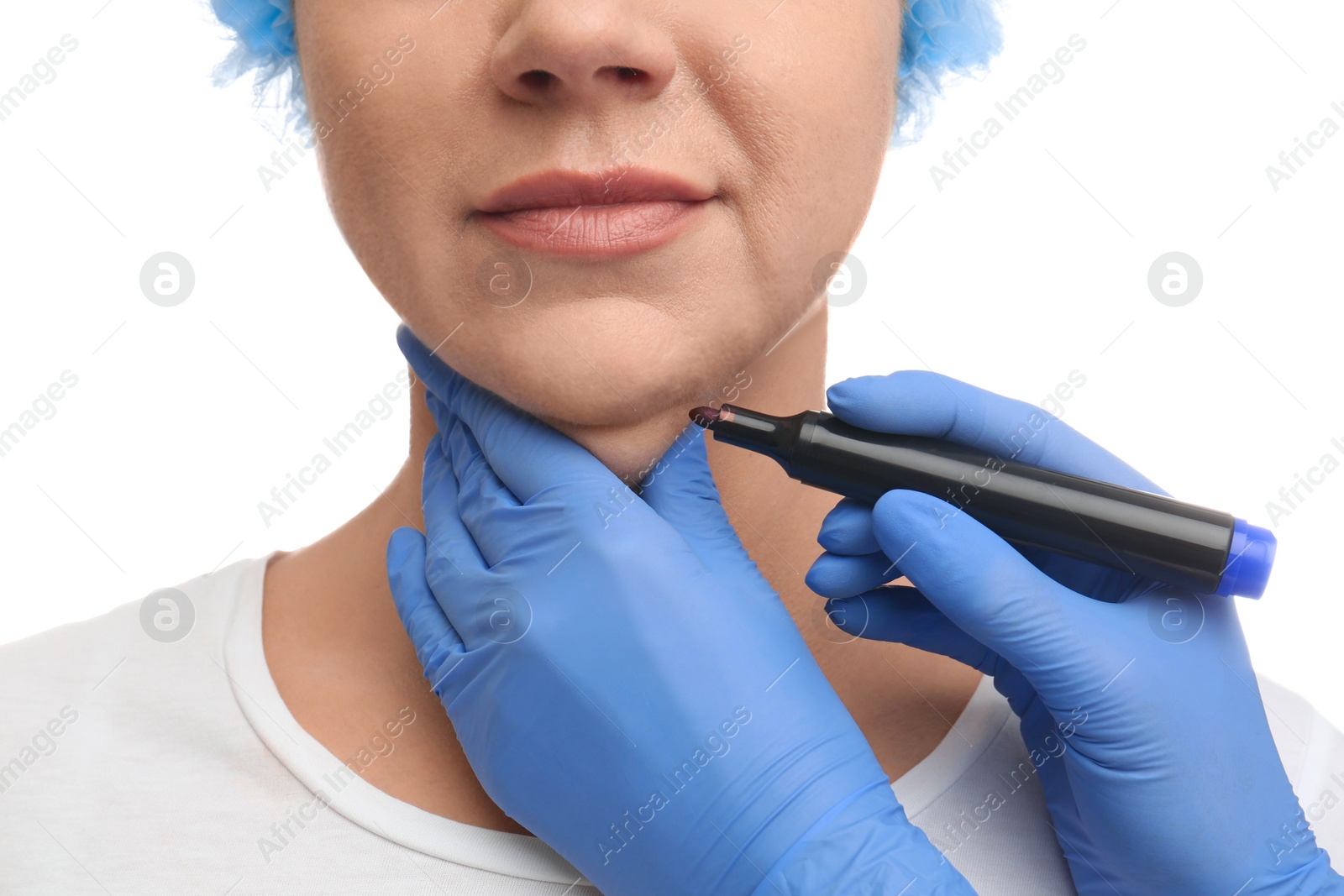 Photo of Surgeon with marker preparing woman for operation against white background, closeup. Double chin removal