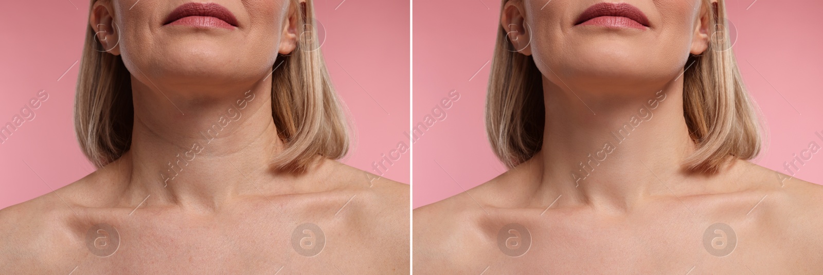 Image of Aging skin changes. Collage with photos of mature woman before and after cosmetic procedure on pink background, closeup