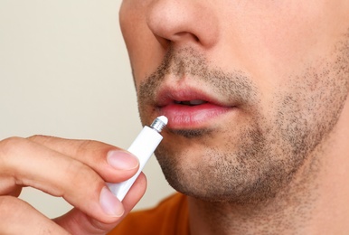 Image of Young man with cold sore applying cream on lips against light background, closeup