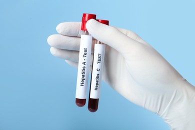 Photo of Scientist holding tubes with blood samples for hepatitis virus test on light blue background, closeup