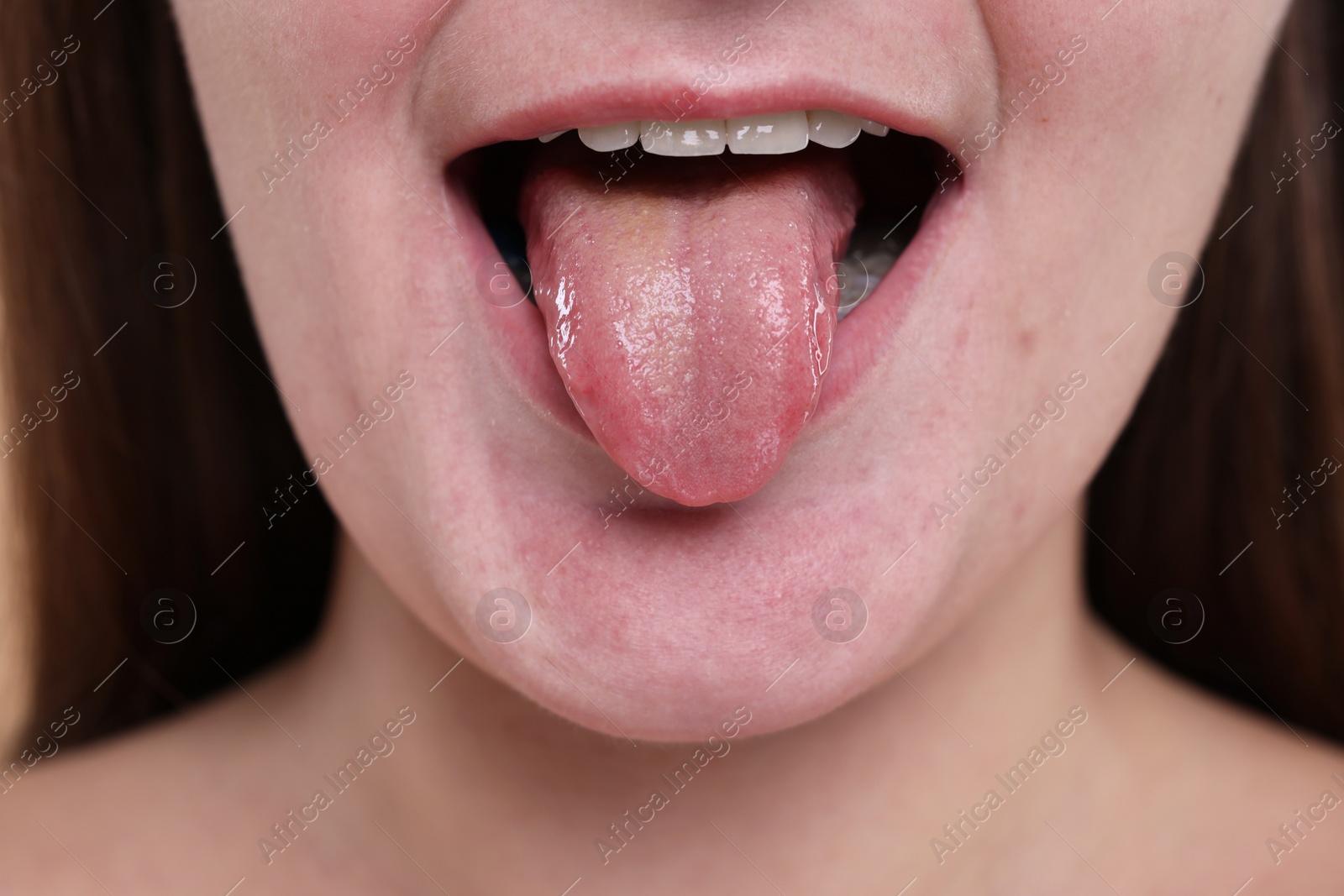 Photo of Closeup view of woman showing her tongue