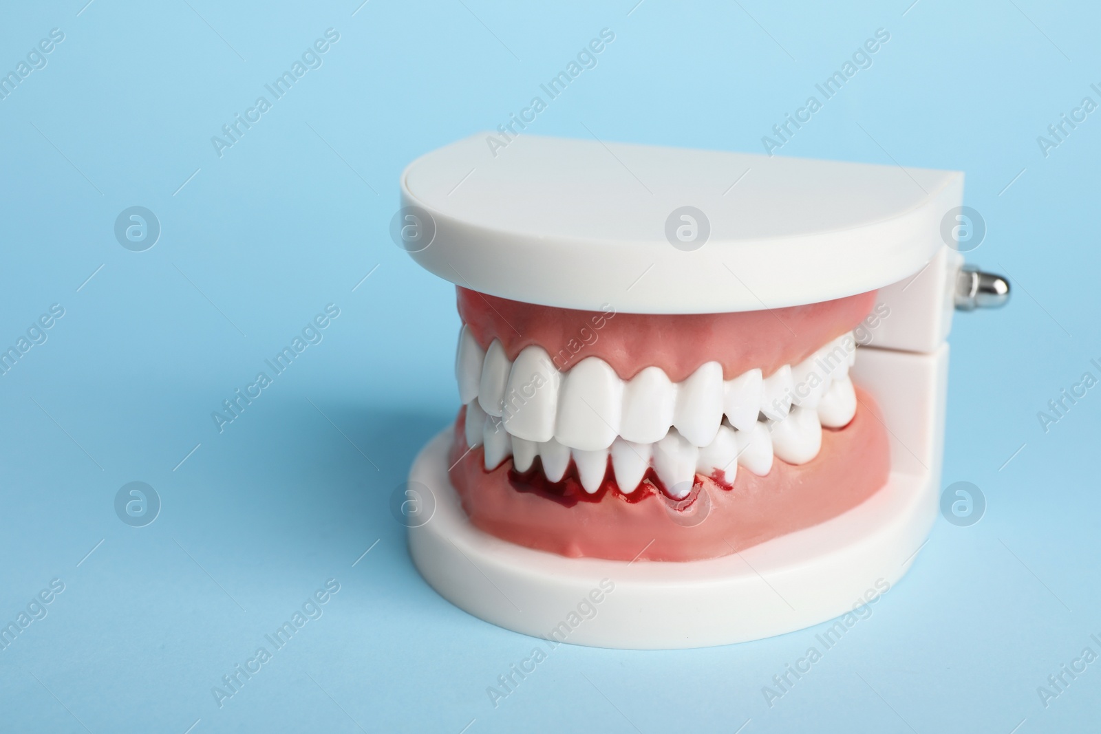 Photo of Jaw model with blood on teeth against light blue background, space for text. Gum inflammation
