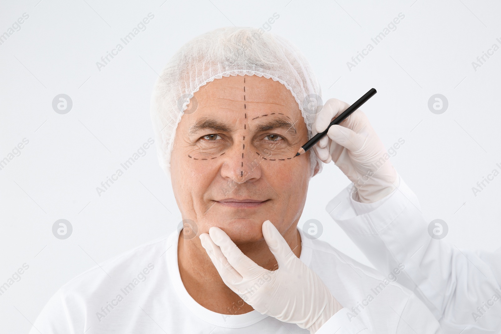 Photo of Doctor marking senior man face before cosmetic surgery on white background