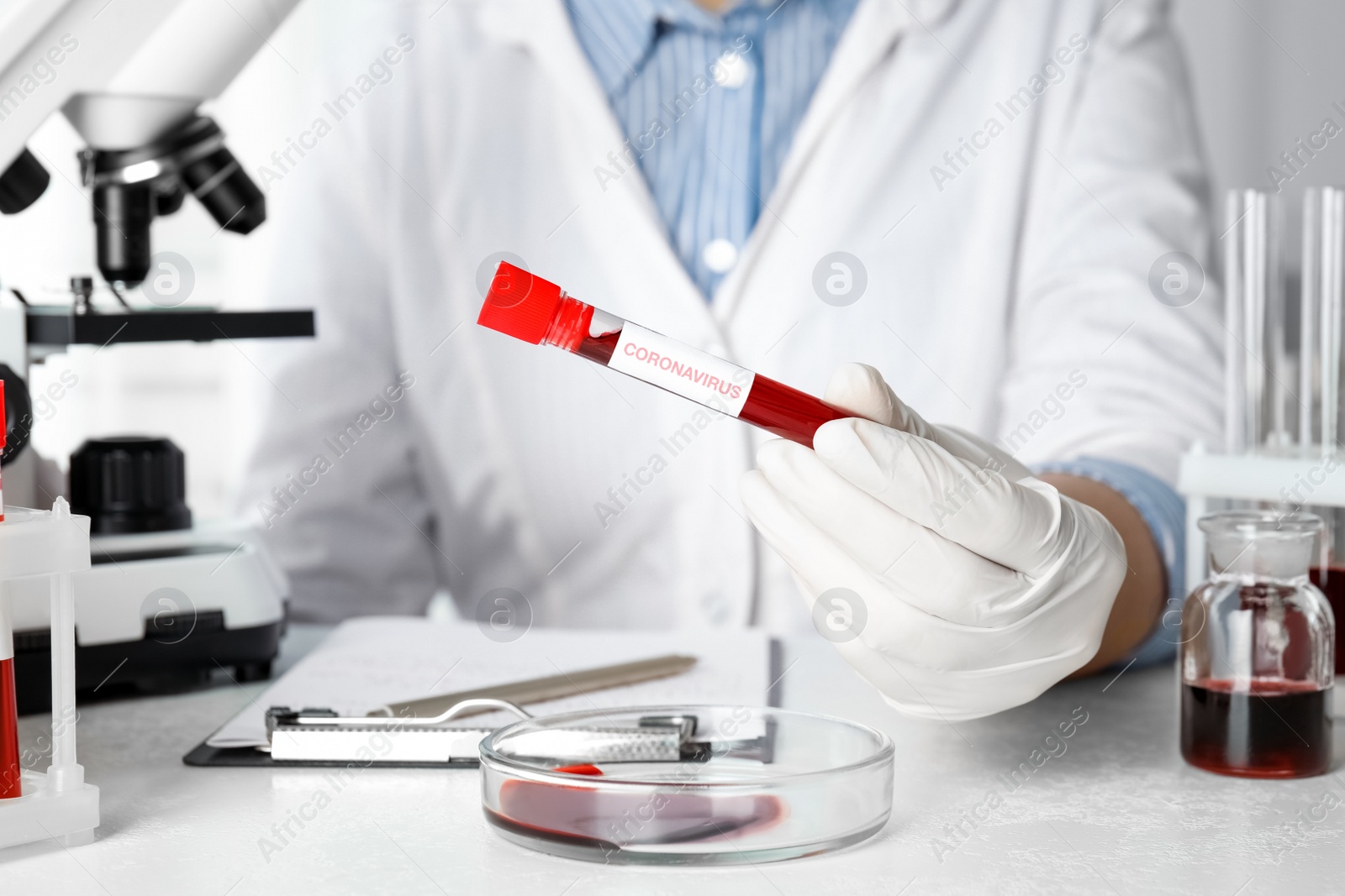 Photo of Scientist holding test tube with blood sample and label CORONA VIRUS in laboratory, closeup