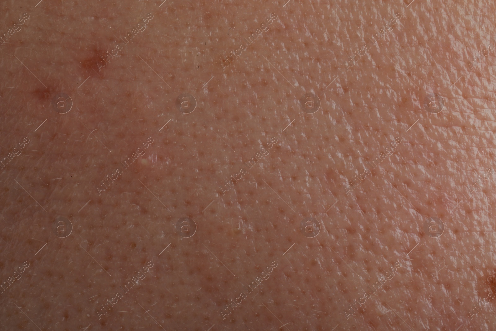 Photo of Closeup view of human skin as background