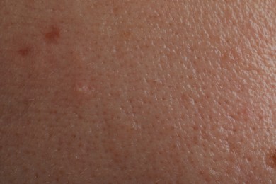 Closeup view of human skin as background