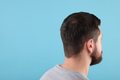 Photo of Man with dandruff in his dark hair on light blue background, space for text