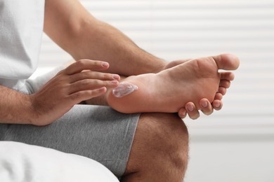 Photo of Man with dry skin applying cream onto his foot on bed, closeup