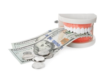 Photo of Educational dental typodont model, dollar banknotes and coins on white background. Expensive treatment