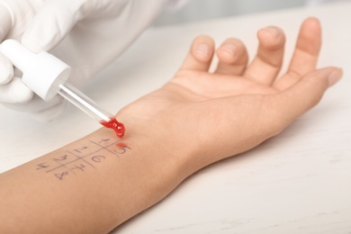 Photo of Doctor making allergy test at table, closeup