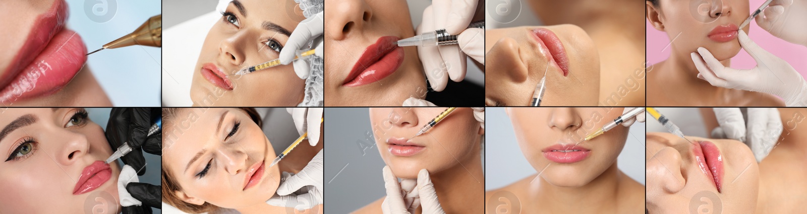 Image of Collage with photos of women during procedures of lip augmentation and permanent makeup, closeup. Banner design