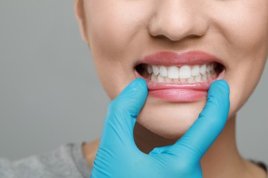 Doctor examining woman's gums on grey background, closeup