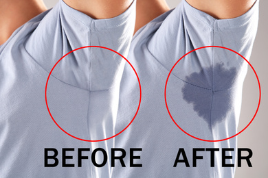 Man before and after using deodorant on light background, closeup