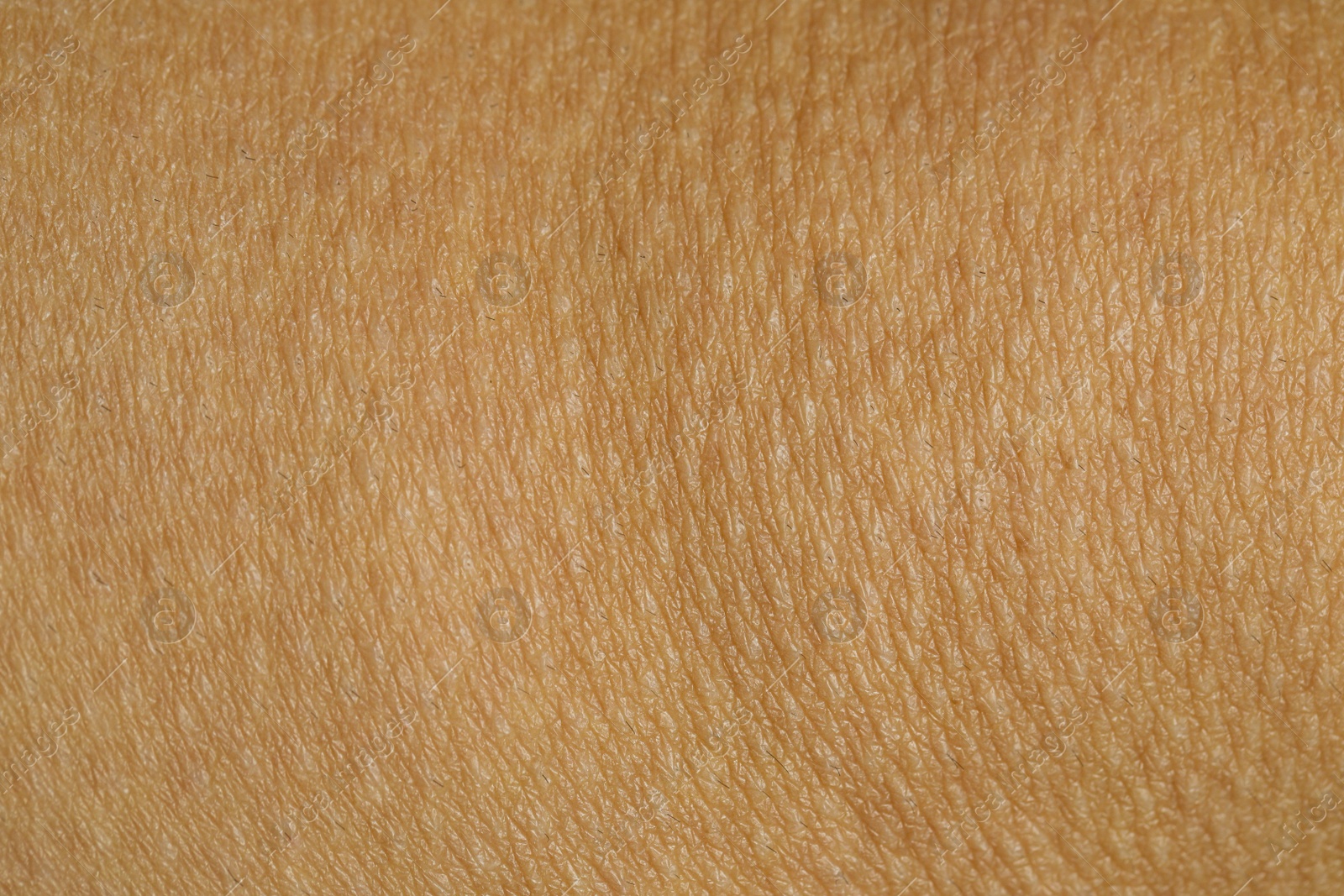 Photo of Texture of human skin as background, closeup view