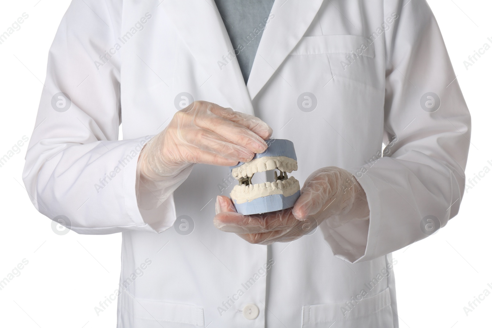 Photo of Doctor holding dental model with jaws on white background, closeup. Cast of teeth