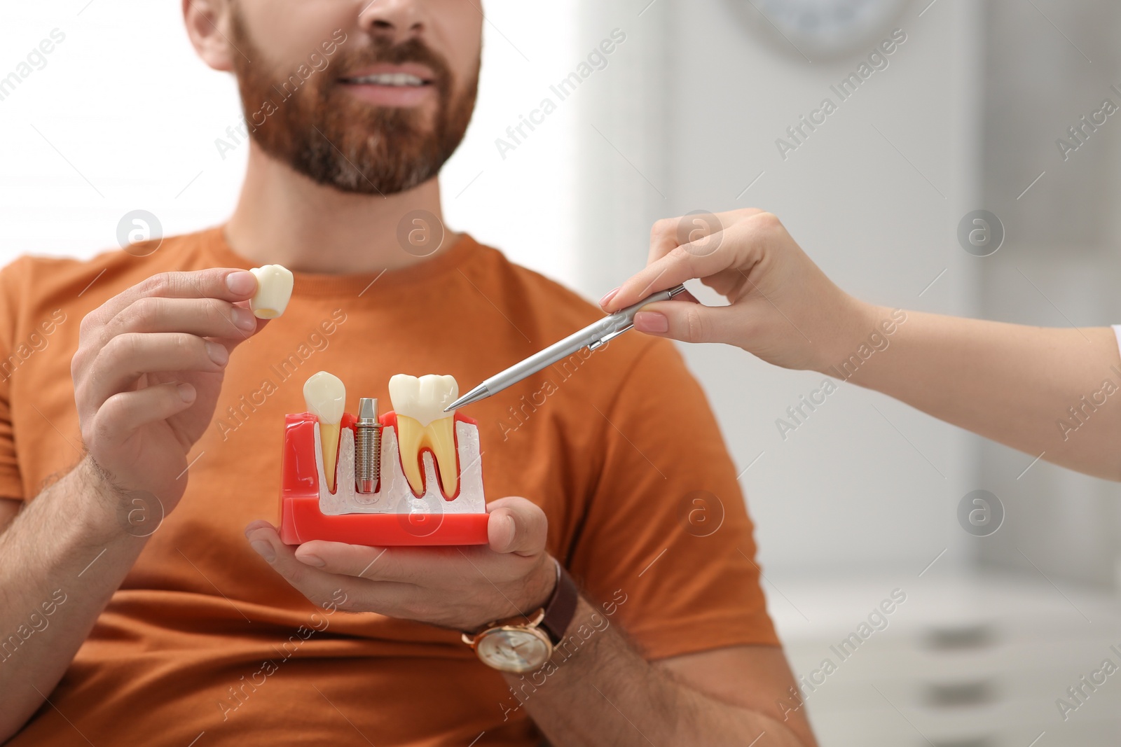 Photo of Doctor with educational model of dental implant consulting patient in clinic, closeup