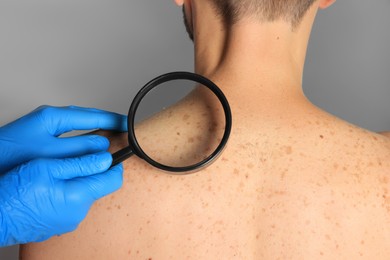 Dermatologist examining patient's birthmark with magnifying glass on grey background, closeup