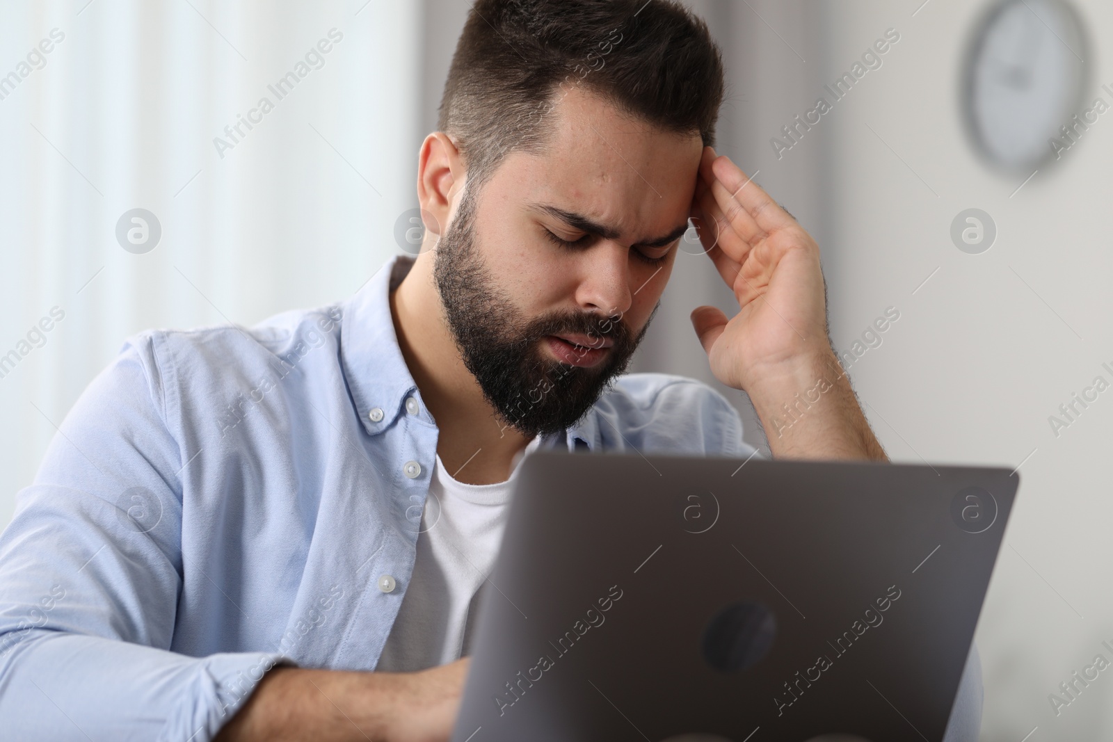 Photo of Man suffering from headache at workplace in office