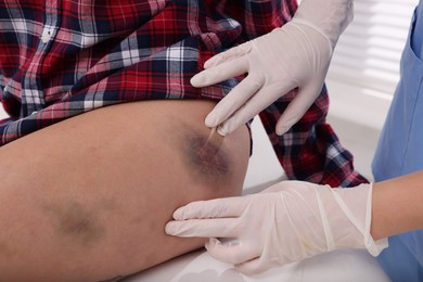 Doctor examining patient's bruised hip in hospital, closeup