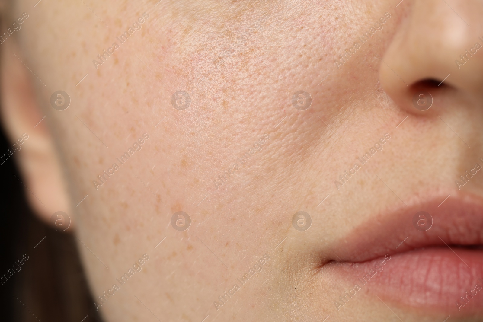 Photo of Macro view of woman with dry skin