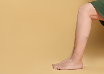 Closeup view of woman with varicose veins on yellow background. Space for text