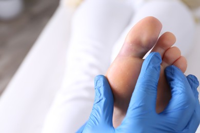 Photo of Doctor checking woman's foot with bruise at hospital, closeup