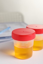 Photo of Containers with urine samples for analysis on white table in laboratory