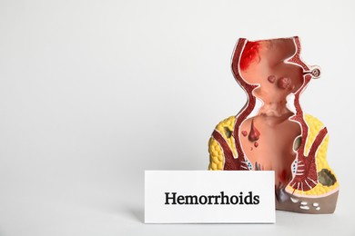 Model of unhealthy lower rectum and card with word Hemorrhoids on light background. Space for text
