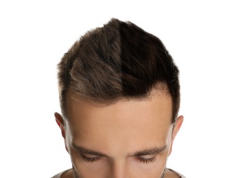 Image of Closeup view of man before and after hair dyeing on white background 