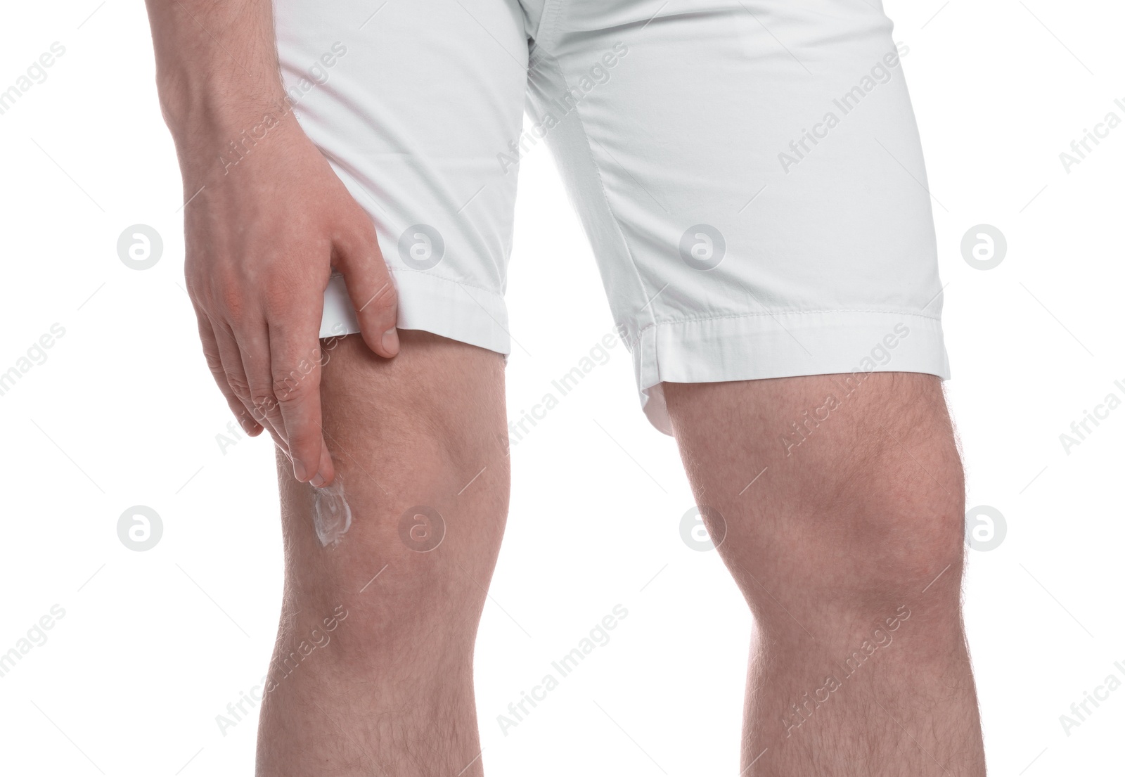 Photo of Man applying ointment onto his knee on white background, closeup