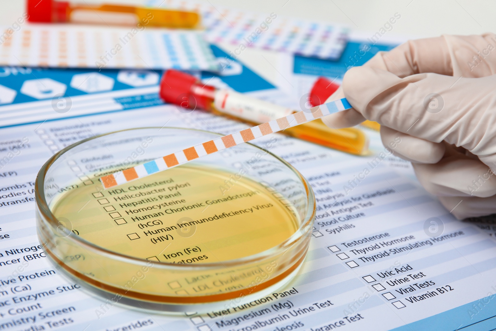 Photo of Doctor doing urine analysis at table, closeup