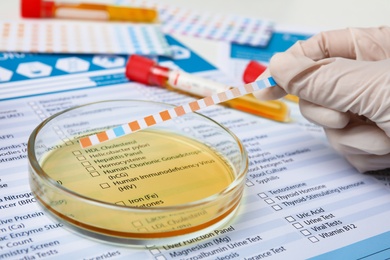 Photo of Doctor doing urine analysis at table, closeup