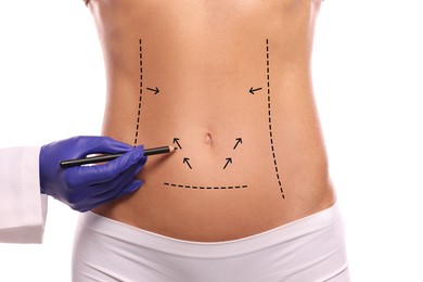 Woman preparing for cosmetic surgery, white background. Doctor drawing markings on her abdomen, closeup