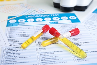 Photo of Test tube with urine sample for analysis on laboratory test form