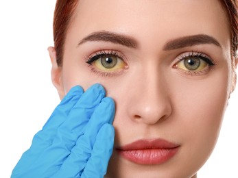 Doctor checking woman with yellow eyes on white background, closeup. Symptom of hepatitis