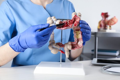 Photo of Gastroenterologist showing human colon model at table in clinic, closeup