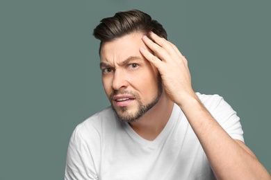 Young man with hair loss problem on color background