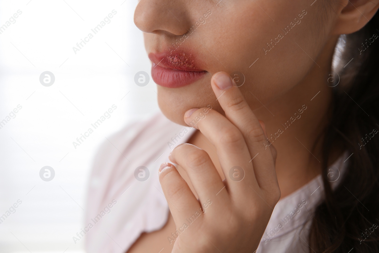 Photo of Woman with herpes touching lips against light background, closeup