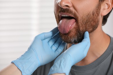Doctor in medical gloves examining man`s oral cavity on blurred background, closeup