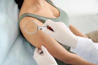 Dermatologist examining patient's birthmark with magnifying glass in clinic, closeup