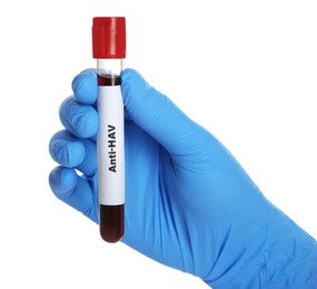 Photo of Scientist holding tube with blood sample and label Anti-HAV on white background, closeup