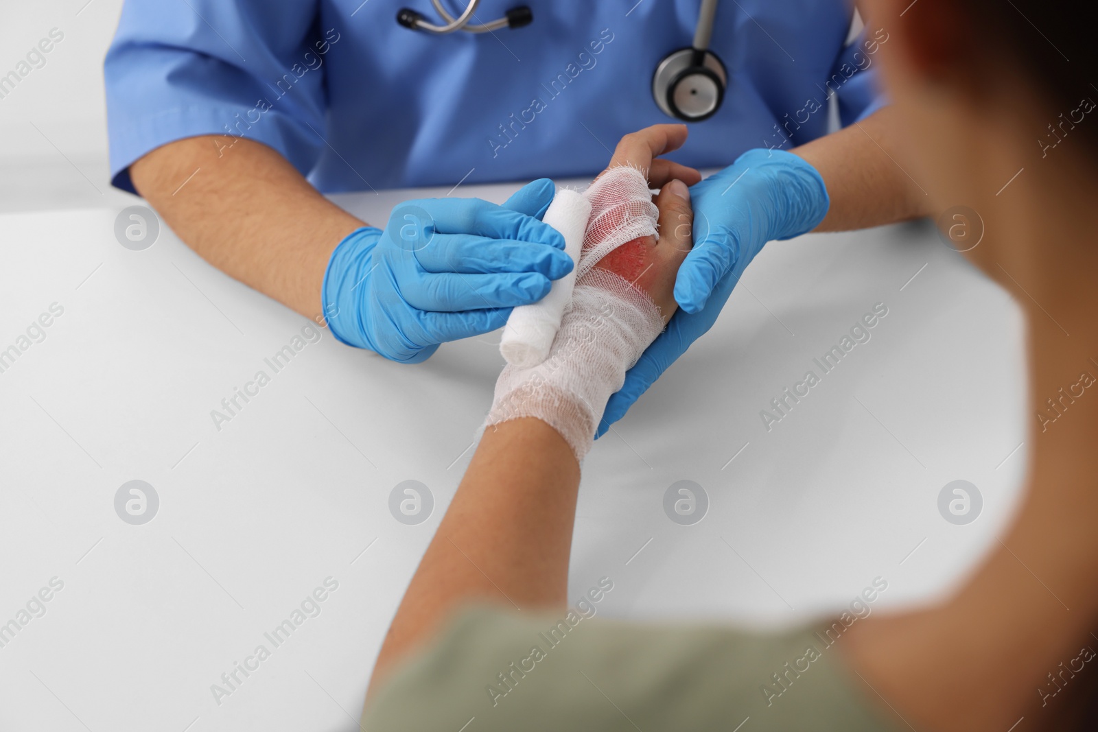 Photo of Doctor bandaging patient's burned hand at table, closeup