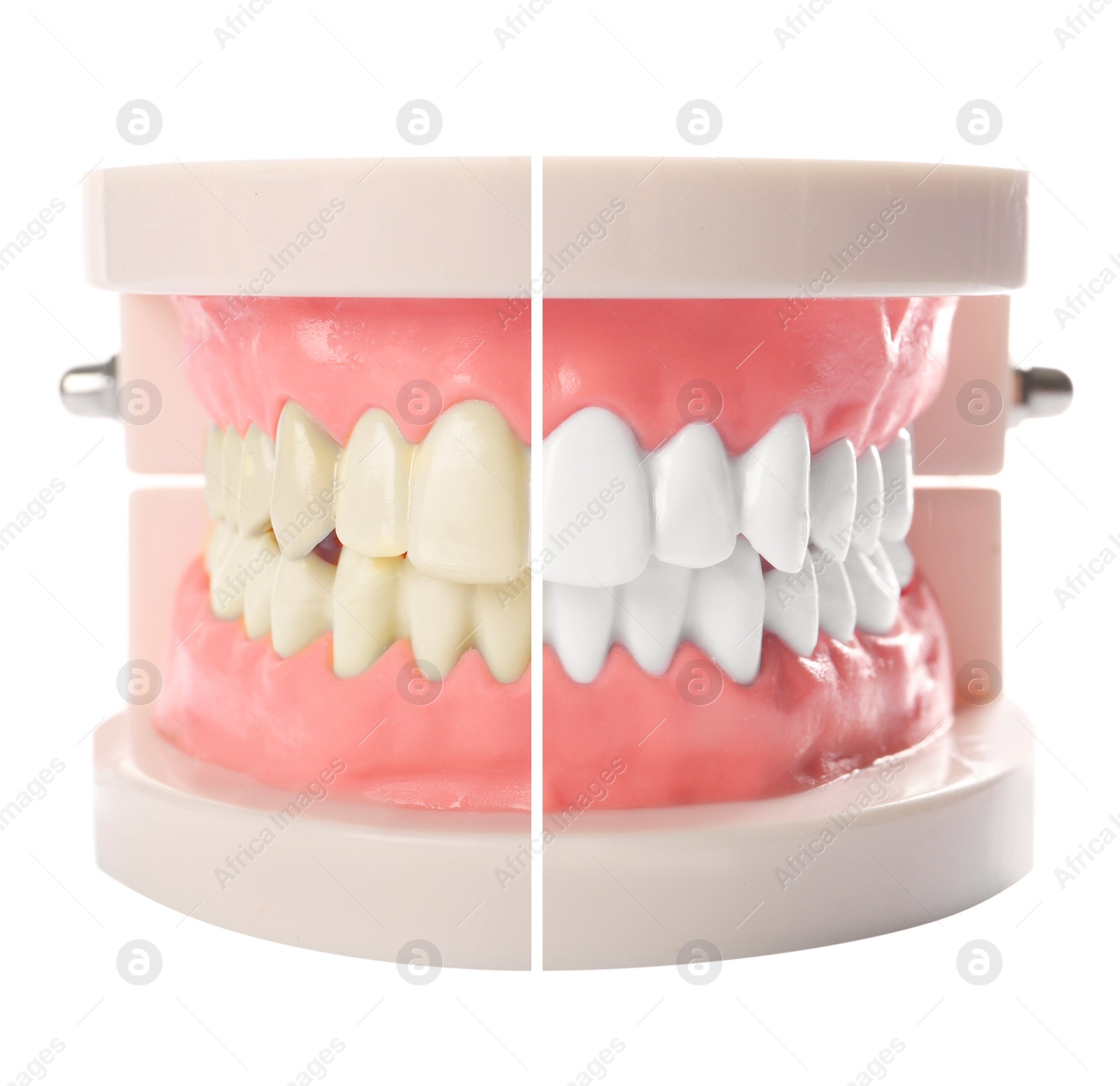 Image of Model of oral cavity with teeth before and after whitening on white background