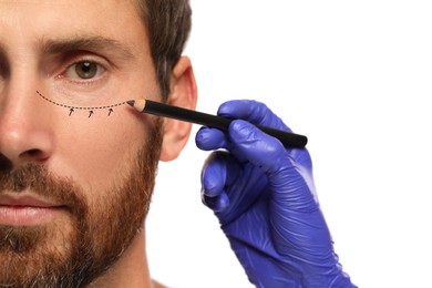 Man preparing for cosmetic surgery, white background. Doctor drawing markings on his face, closeup