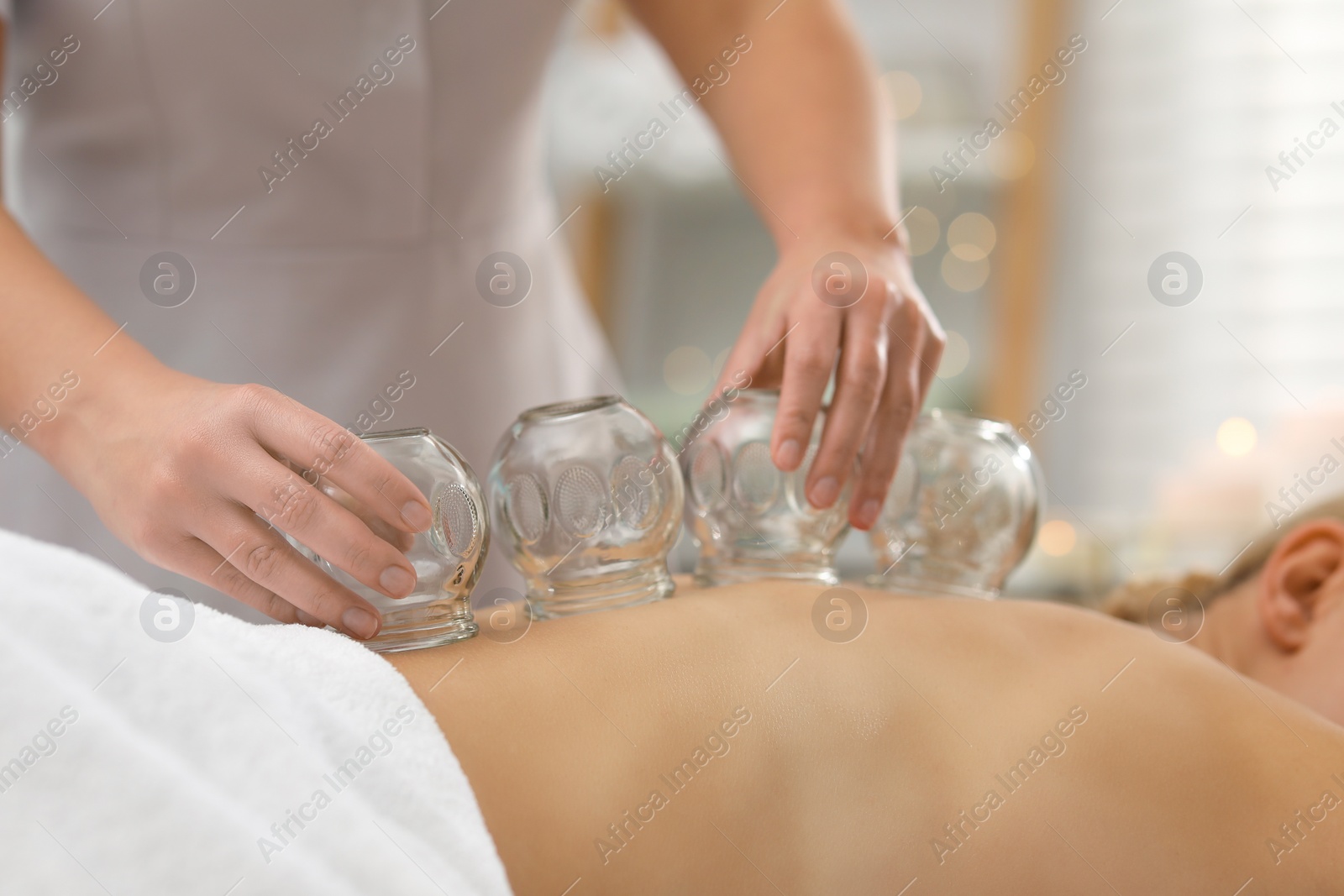 Photo of Therapist giving cupping treatment to patient indoors, closeup